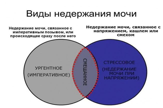 Виды недержания мочи