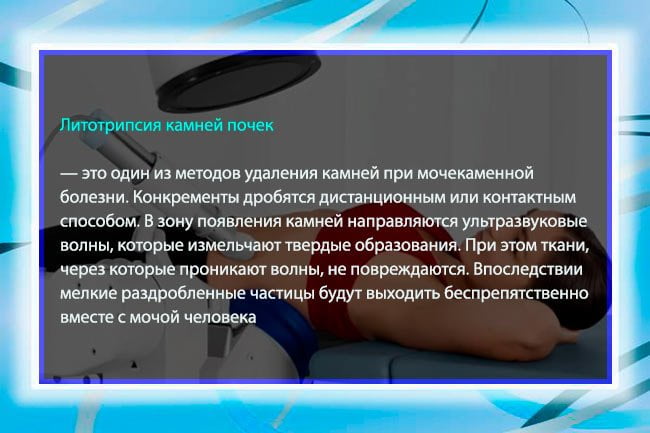 Дистанционная литотрипсия