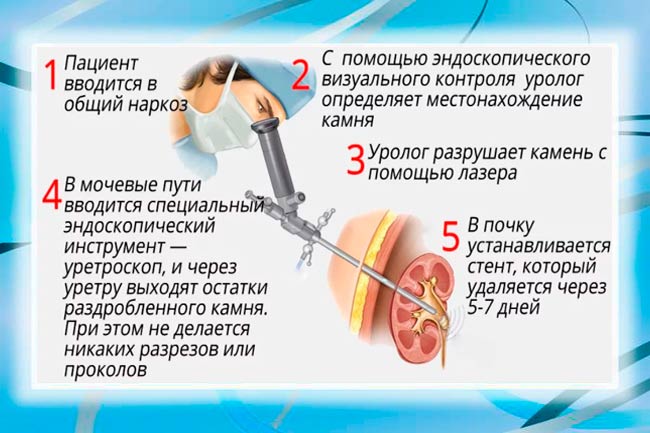 Современные методы лечения почек