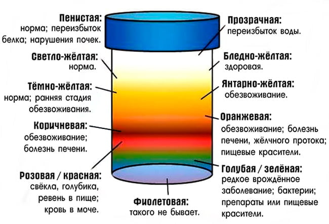 Цвета мочи