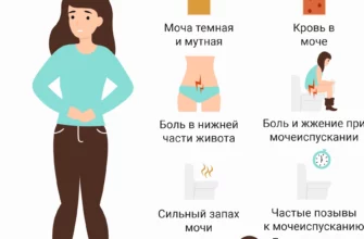 Катаральный цистит: симптомы, причины, лечение