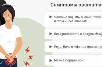 Промывание мочевого пузыря при цистите: эффективные методы и рекомендации