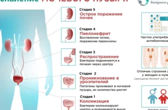 Симптомы болезни мочевого пузыря у женщин: основные признаки и диагностика