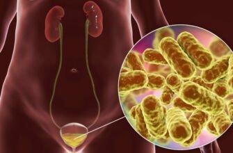 Сколько времени длится лечение цистита у мужчин: основные сроки и методы