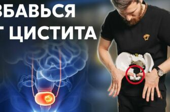 Сода для лечения цистита: эффективные ванночки