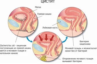 Тригонит: характеристики, области применения и особенности этого материала