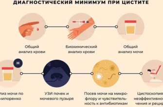 Ванна с ромашкой от цистита: эффективное средство для снятия симптомов